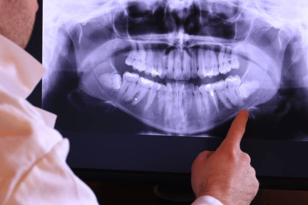Best Broken or Chipped Tooth Repair in Redway, CA